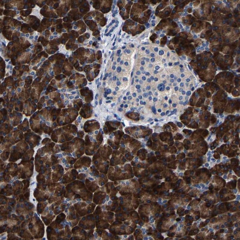 NKCC1/SLC12A2 Antibody - BSA Free Immunohistochemistry-Paraffin: NKCC1/SLC12A2 Antibody - BSA Free [NBP1-89928]