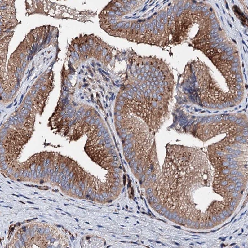 WDR11 Antibody - BSA Free Immunohistochemistry-Paraffin: WDR11 Antibody [NBP1-89930]
