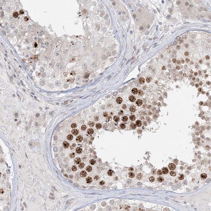 Brk Antibody - BSA Free Immunohistochemistry: Brk Antibody - BSA Free [NBP1-89935]