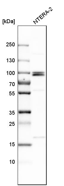 MCPH1 Antibody - BSA Free Western Blot: MCPH1 Antibody - BSA Free [NBP1-89937]