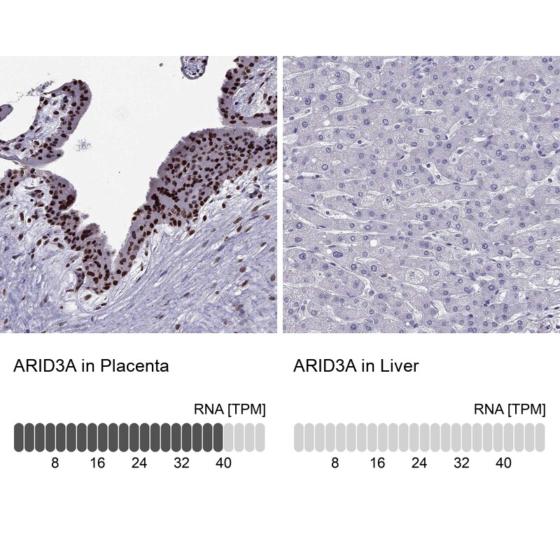DRIL1 Antibody - BSA Free Immunohistochemistry-Paraffin: DRIL1 Antibody - BSA Free [NBP1-89938]