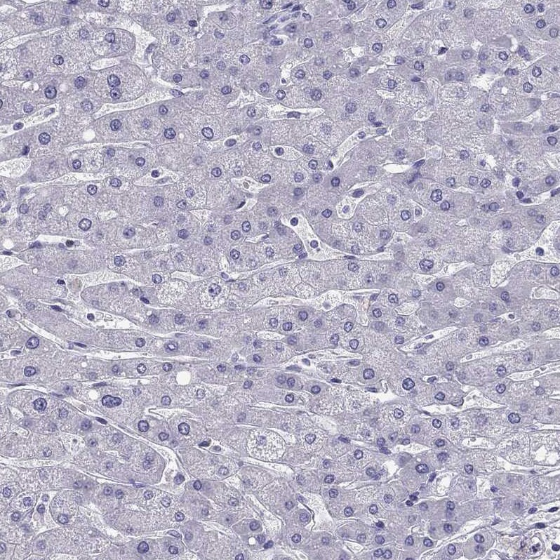 DRIL1 Antibody - BSA Free Immunohistochemistry-Paraffin: DRIL1 Antibody - BSA Free [NBP1-89938]