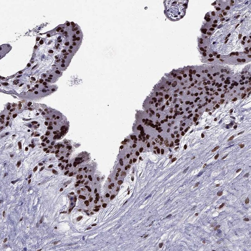 DRIL1 Antibody - BSA Free Immunohistochemistry-Paraffin: DRIL1 Antibody - BSA Free [NBP1-89938]