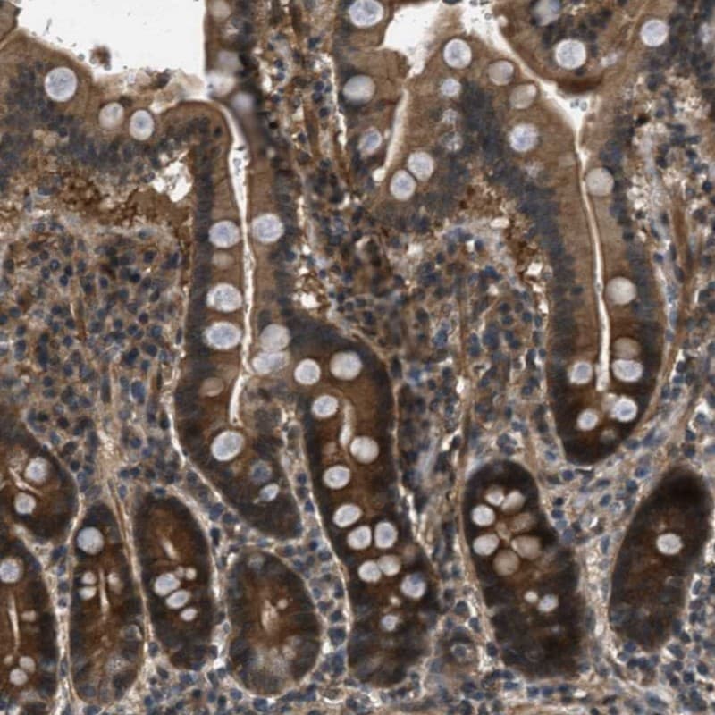 Epithelial Stromal Interaction 1 Antibody - BSA Free Immunohistochemistry-Paraffin: Epithelial Stromal Interaction 1 Antibody - BSA Free [NBP1-89940]