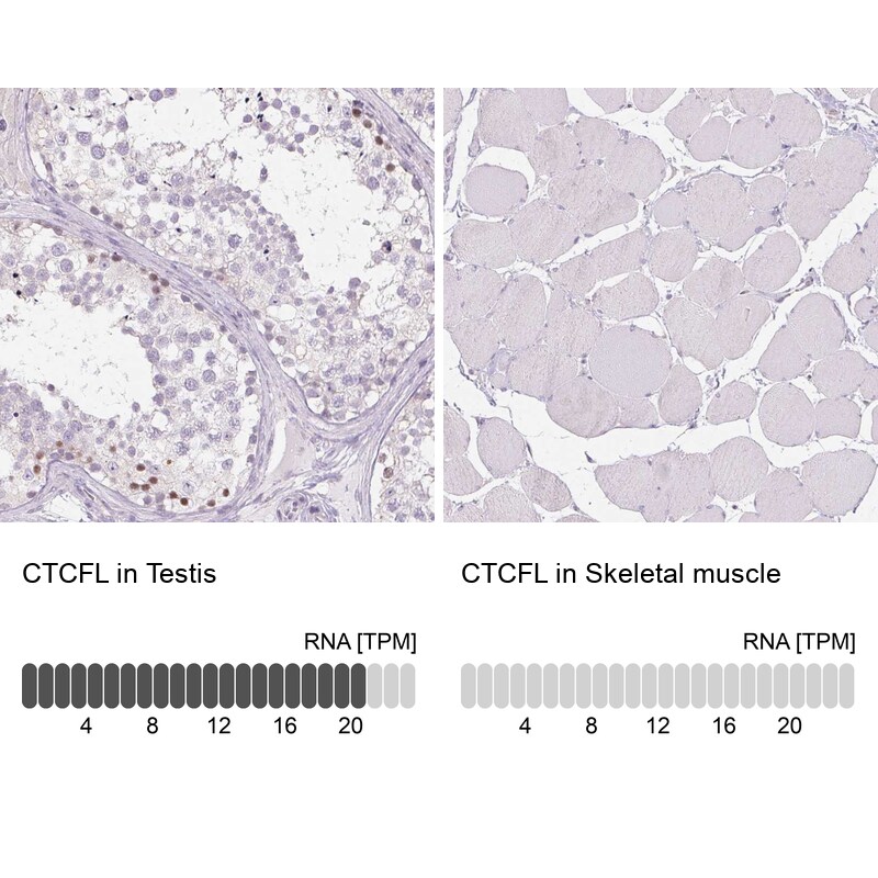 BORIS Antibody - BSA Free Immunohistochemistry-Paraffin: BORIS Antibody - BSA Free [NBP1-89947]
