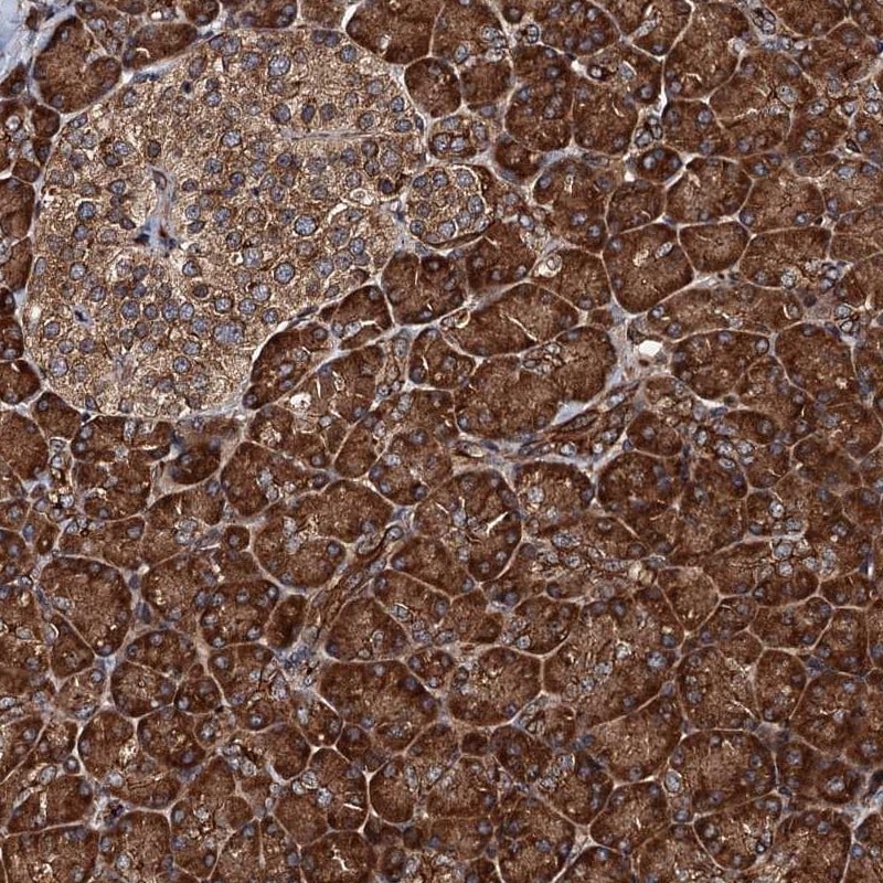 Bora Antibody - BSA Free Immunohistochemistry-Paraffin: Bora Antibody [NBP1-89948]