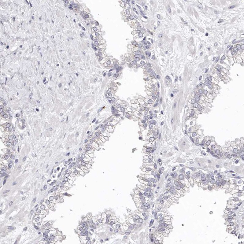 Borealin Antibody - BSA Free Immunohistochemistry-Paraffin: Borealin Antibody - BSA Free [NBP1-89949]