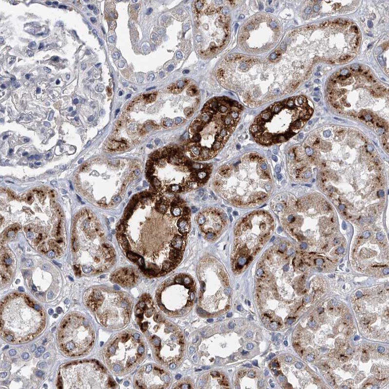 Osteopontin/OPN Antibody - BSA Free Immunohistochemistry-Paraffin: Osteopontin/OPN Antibody - BSA Free [NBP1-89952]