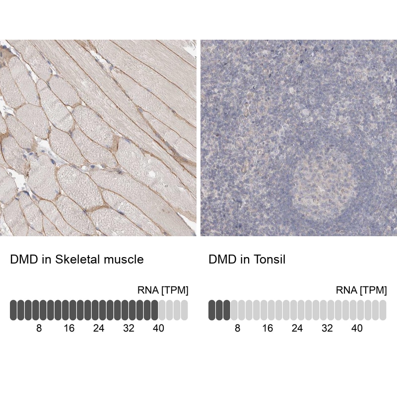Dystrophin Antibody - BSA Free Immunohistochemistry-Paraffin: Dystrophin Antibody - BSA Free [NBP1-89953]