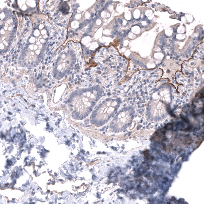 Laminin alpha 3 Antibody - BSA Free Immunohistochemistry-Paraffin: Laminin alpha 3 Antibody - BSA Free [NBP1-89955]