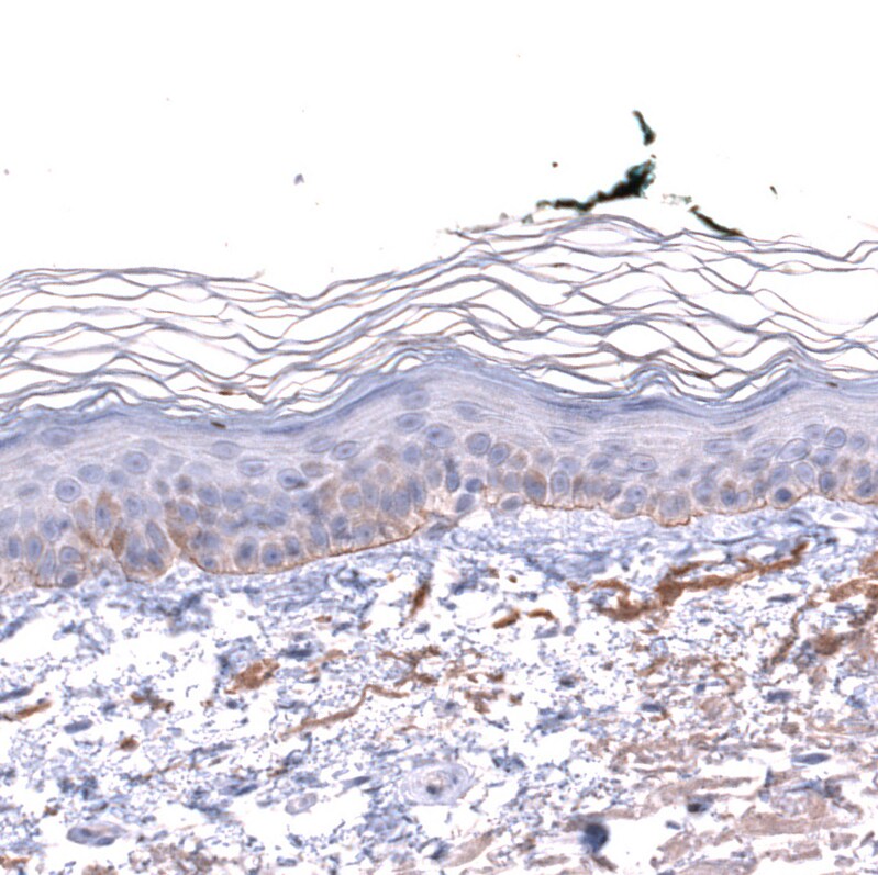 Laminin alpha 3 Antibody - BSA Free Immunohistochemistry-Paraffin: Laminin alpha 3 Antibody - BSA Free [NBP1-89955]