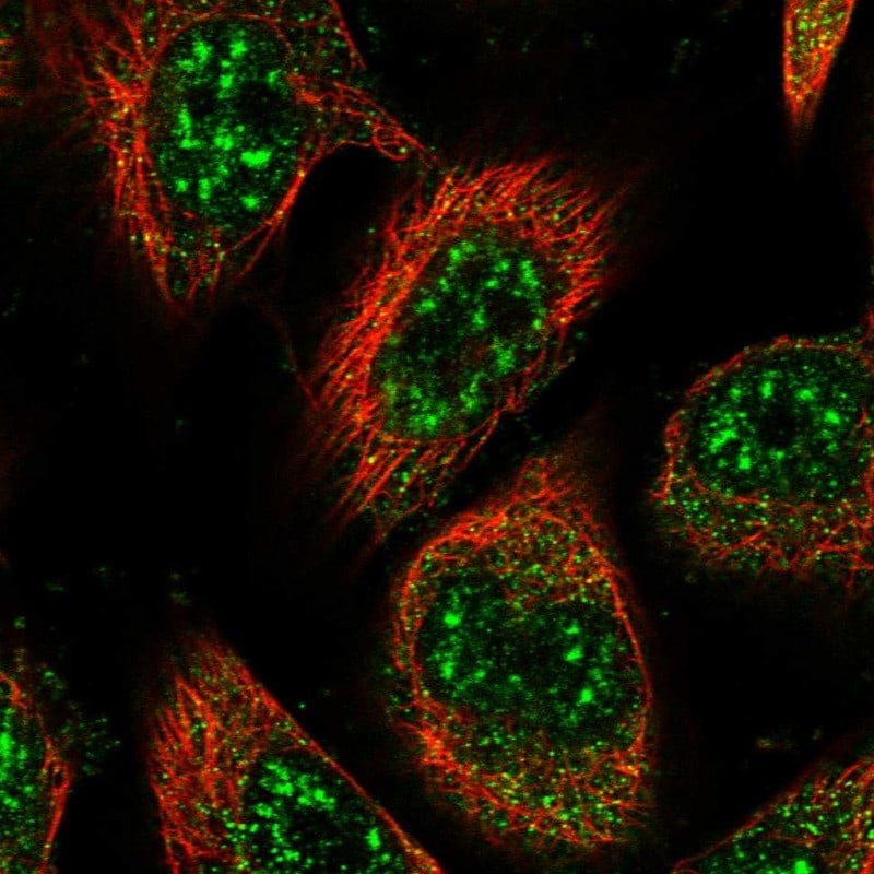 RMI2 Antibody - BSA Free Immunocytochemistry/ Immunofluorescence: RMI2 Antibody [NBP1-89962]