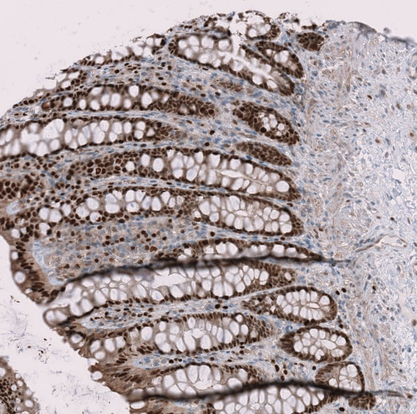 RMI2 Antibody - BSA Free Immunohistochemistry-Paraffin: RMI2 Antibody - BSA Free [NBP1-89962]