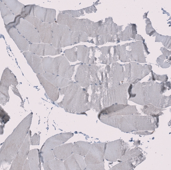 RMI2 Antibody - BSA Free Immunohistochemistry-Paraffin: RMI2 Antibody - BSA Free [NBP1-89962]