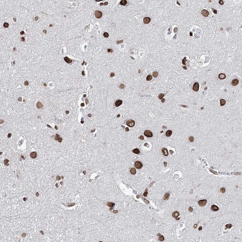C22orf9 Antibody - BSA Free Immunohistochemistry-Paraffin: C22orf9 Antibody - BSA Free [NBP1-89965]