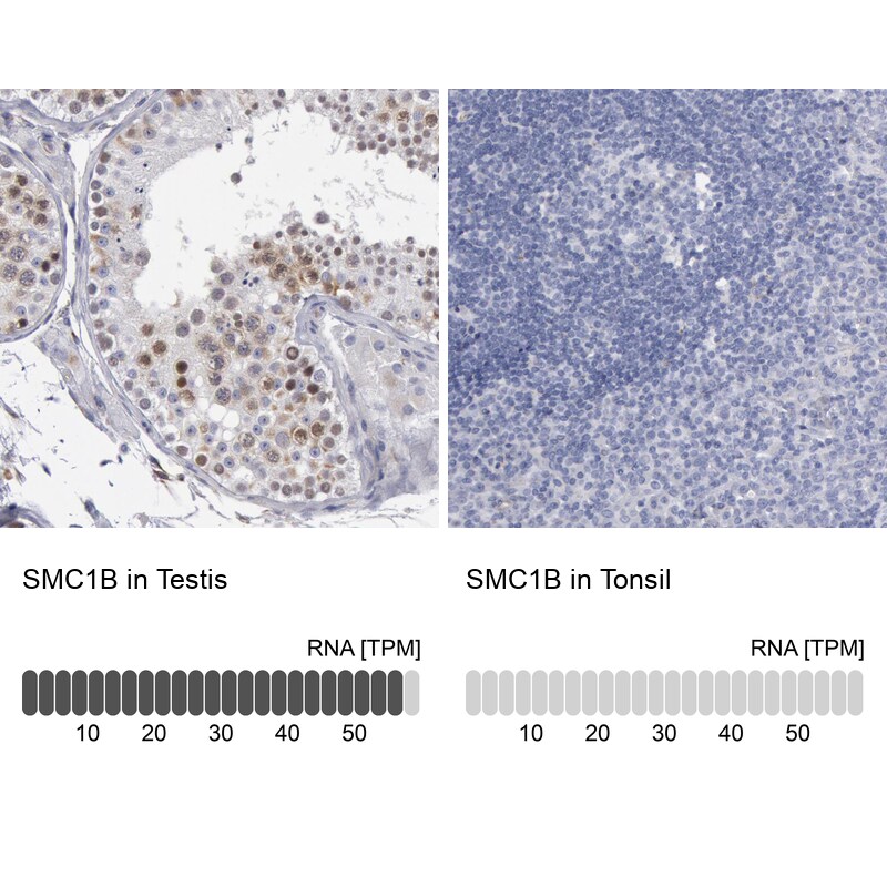SMC1L2 Antibody - BSA Free Immunohistochemistry-Paraffin: SMC1L2 Antibody - BSA Free [NBP1-89966]