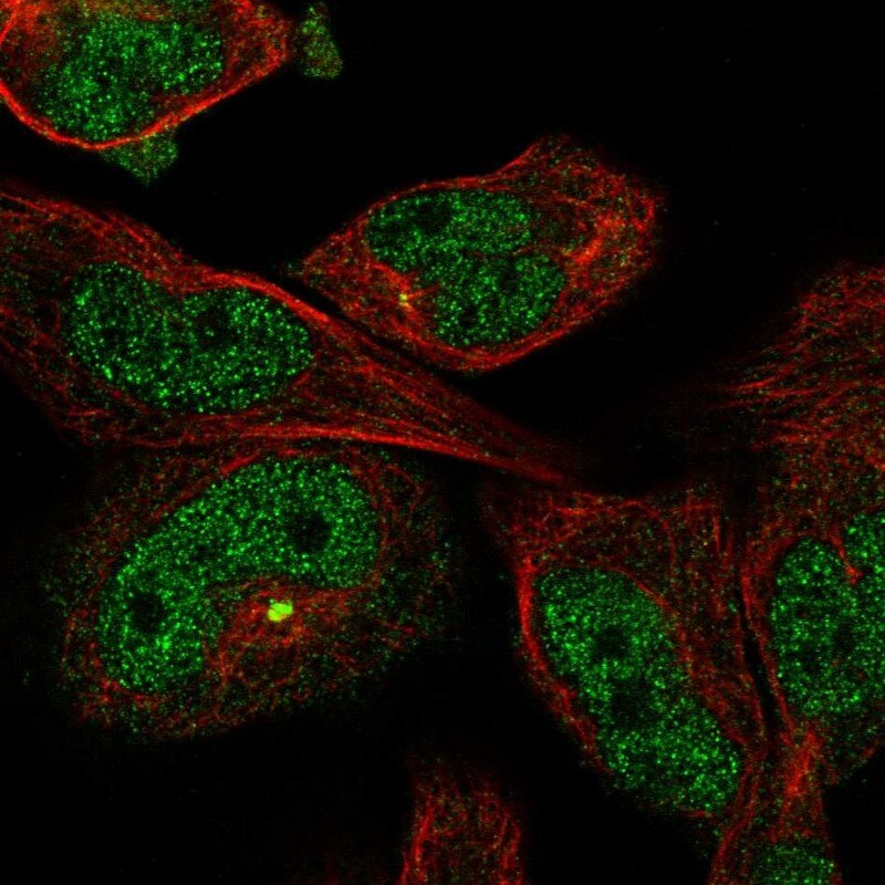 Myosin 18B Antibody - BSA Free Immunocytochemistry/ Immunofluorescence: Myosin 18B Antibody - BSA Free [NBP1-89967]