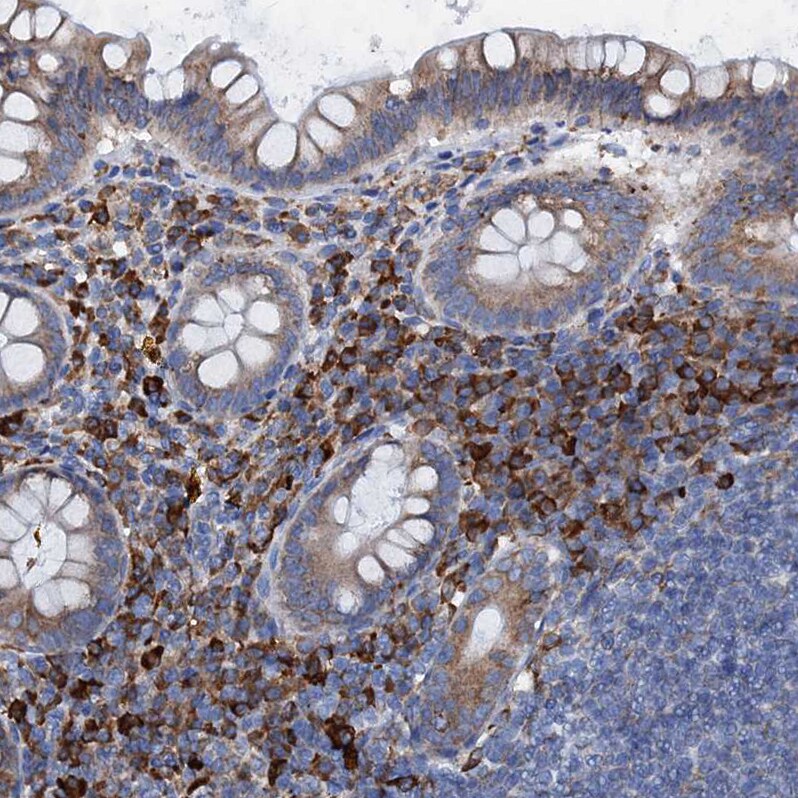 GRP78/HSPA5 Antibody - BSA Free Immunohistochemistry-Paraffin: GRP78/HSPA5 Antibody - BSA Free [NBP1-89968]