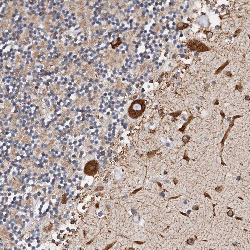 GRP78/HSPA5 Antibody - BSA Free Immunohistochemistry-Paraffin: GRP78/HSPA5 Antibody - BSA Free [NBP1-89968]