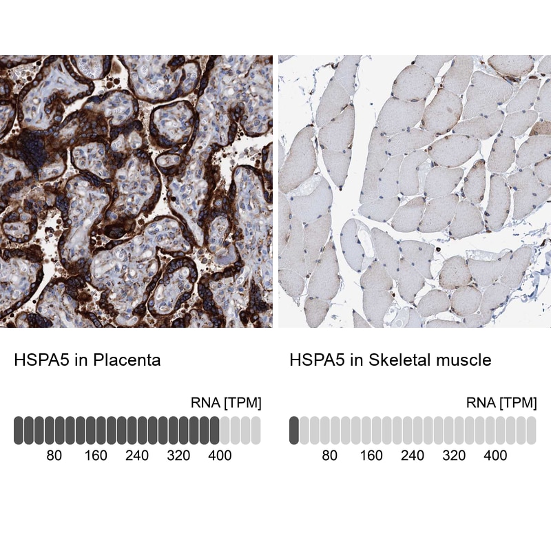 GRP78/HSPA5 Antibody - BSA Free Immunohistochemistry-Paraffin: GRP78/HSPA5 Antibody [NBP1-89969]