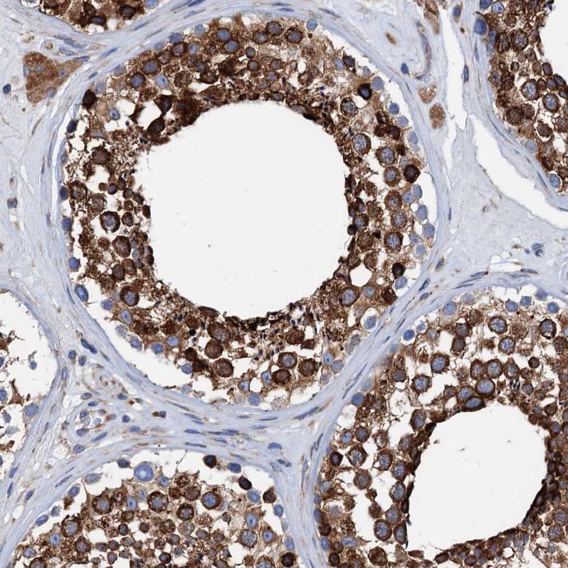 GRP78/HSPA5 Antibody - BSA Free Immunohistochemistry-Paraffin: GRP78/HSPA5 Antibody [NBP1-89969]