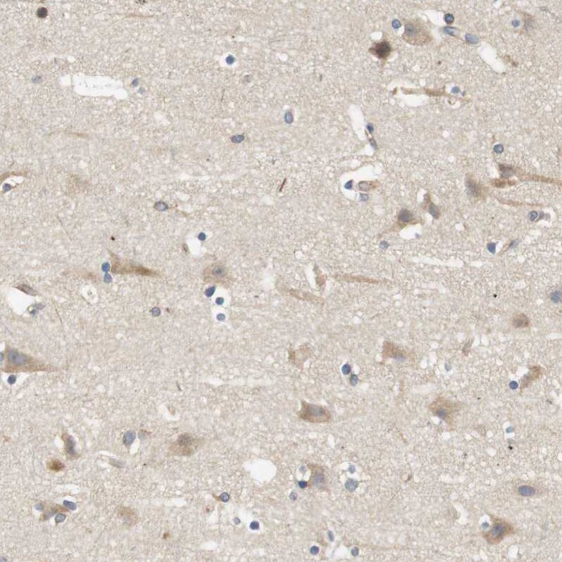 Endophilin B1/Bif-1 Antibody - BSA Free Immunohistochemistry-Paraffin: Endophilin B1/Bif-1 Antibody - BSA Free [NBP1-89972]