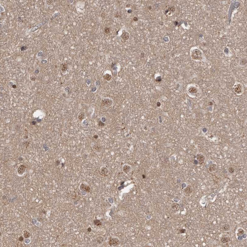 AHR Antibody - BSA Free Immunohistochemistry-Paraffin: AHR Antibody - BSA Free [NBP1-89974]