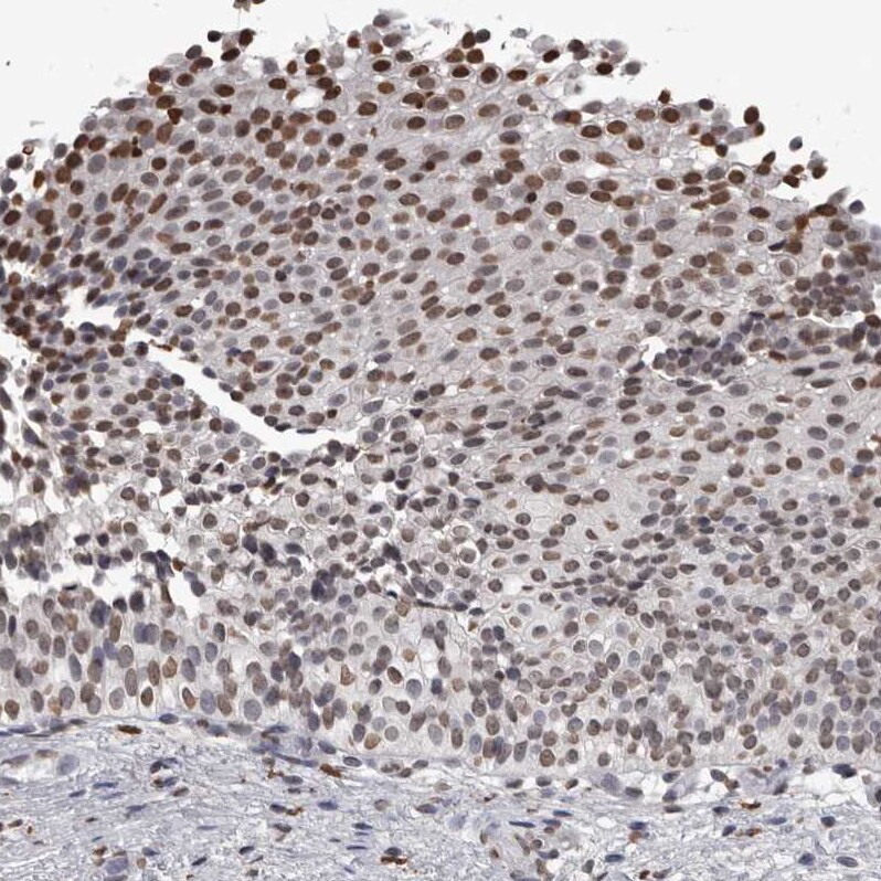 AHR Antibody - BSA Free Immunohistochemistry-Paraffin: AHR Antibody - BSA Free [NBP1-89975]