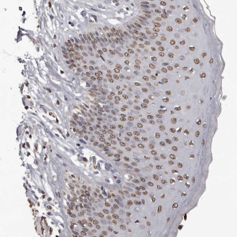 AHR Antibody - BSA Free Immunohistochemistry-Paraffin: AHR Antibody - BSA Free [NBP1-89975]