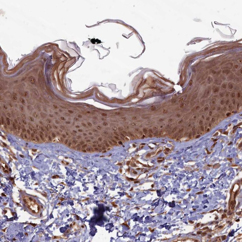 HIF-3 alpha Antibody - BSA Free Immunohistochemistry-Paraffin: HIF-3 alpha Antibody - BSA Free [NBP1-89977]