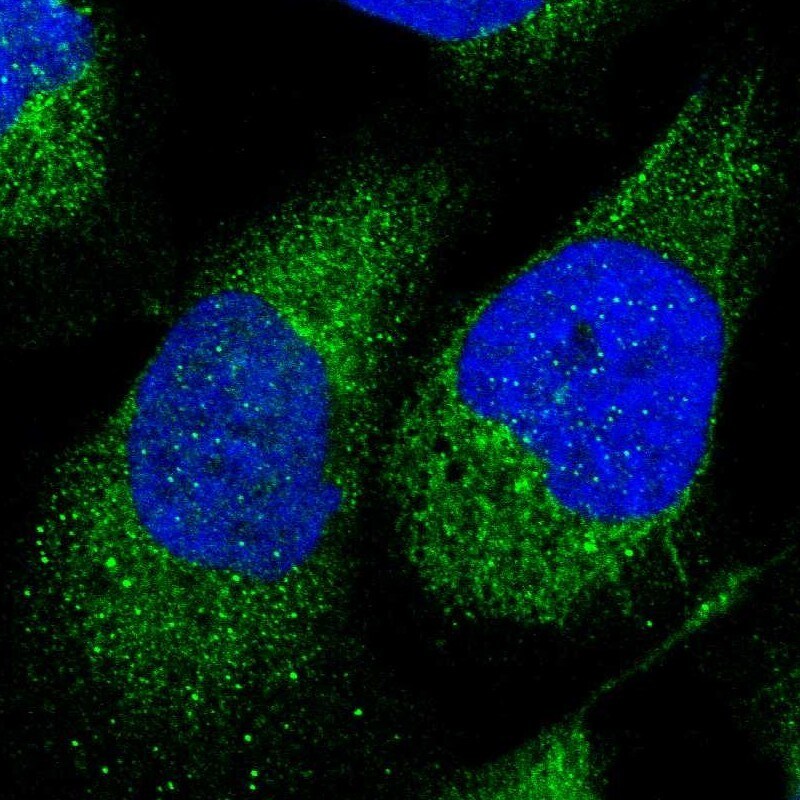 Hey L Antibody - BSA Free Immunocytochemistry/ Immunofluorescence: Hey L Antibody - BSA Free [NBP1-89981]