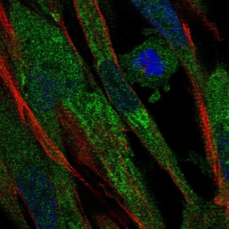 Complement Factor B Antibody - BSA Free Immunocytochemistry/ Immunofluorescence: Complement Factor B Antibody - BSA Free [NBP1-89985]