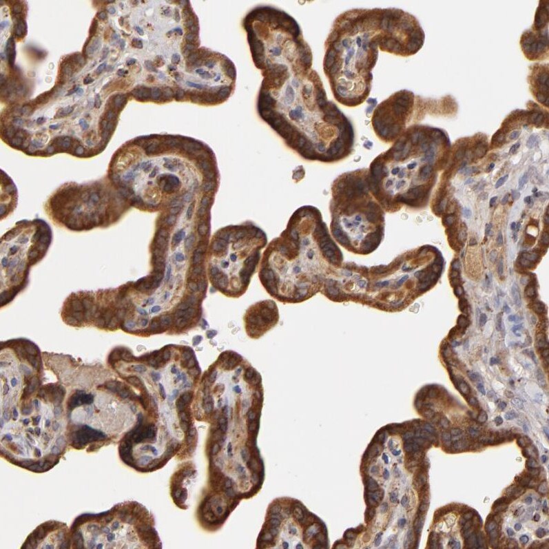 Complement Factor B Antibody - BSA Free Immunohistochemistry-Paraffin: Complement Factor B Antibody - BSA Free [NBP1-89985]