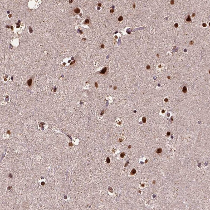 NAC1 Antibody - BSA Free Immunohistochemistry-Paraffin: NAC1 Antibody - BSA Free [NBP1-89991]