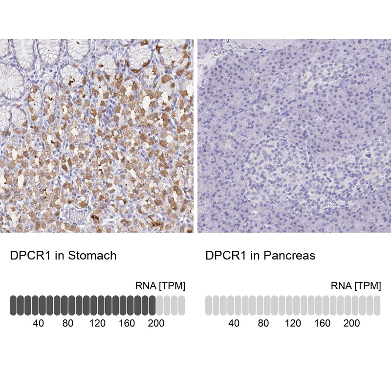 DPCR-1 Antibody - BSA Free Immunohistochemistry-Paraffin: DPCR-1 Antibody - BSA Free [NBP1-89995]