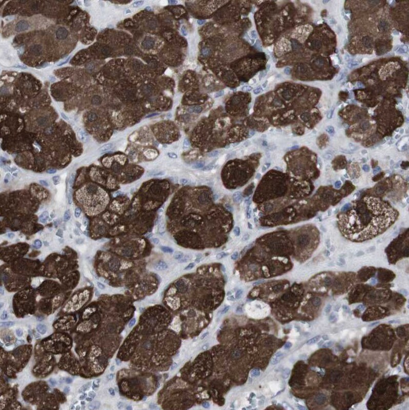 gamma-Synuclein Antibody - BSA Free Immunohistochemistry-Paraffin: gamma-Synuclein Antibody - BSA Free [NBP1-89996]
