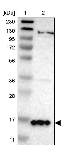 gamma-Synuclein Antibody - BSA Free Western Blot: gamma-Synuclein Antibody - BSA Free [NBP1-89996]