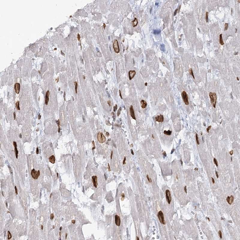 Breast cancer suppressor candidate 1 Antibody - BSA Free Immunohistochemistry-Paraffin: Breast cancer suppressor candidate 1 Antibody [NBP1-89997]