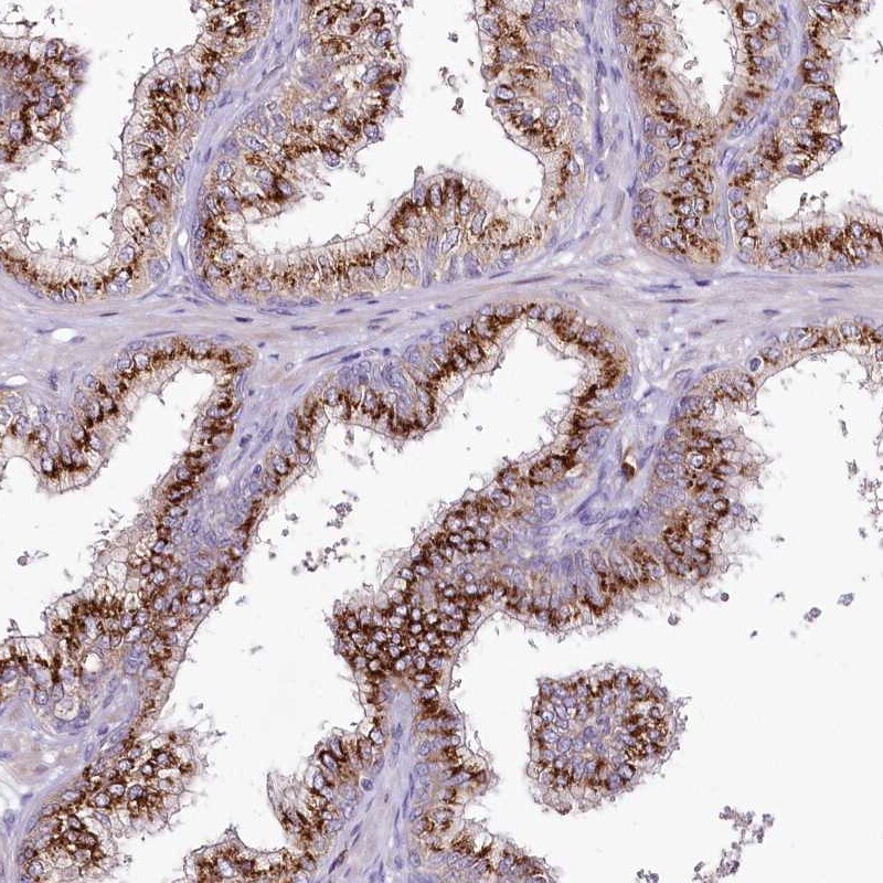 Breast cancer suppressor candidate 1 Antibody - BSA Free Immunohistochemistry-Paraffin: Breast cancer suppressor candidate 1 Antibody [NBP1-89998]