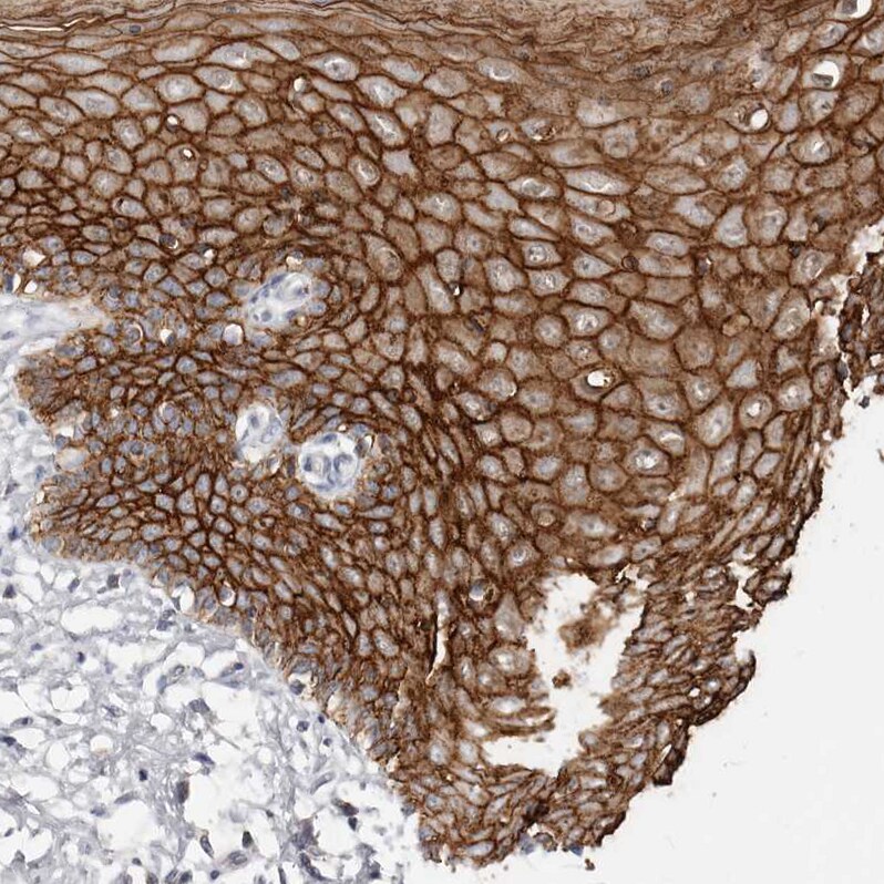 S100 calcium binding protein A14 Antibody - BSA Free Immunohistochemistry-Paraffin: S100 calcium binding protein A14 Antibody - BSA Free [NBP1-90000]