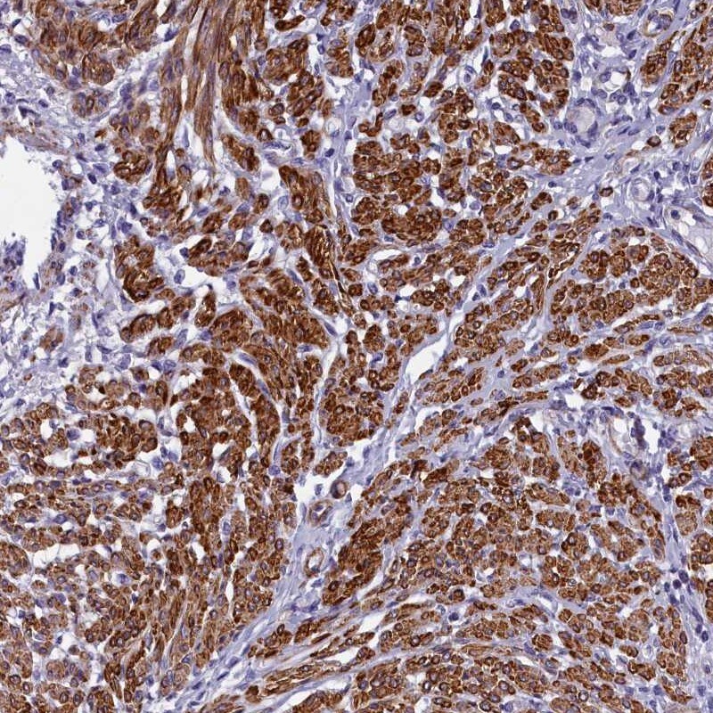 Bcl rambo Antibody - BSA Free Immunohistochemistry-Paraffin: Bcl rambo Antibody [NBP1-90002]