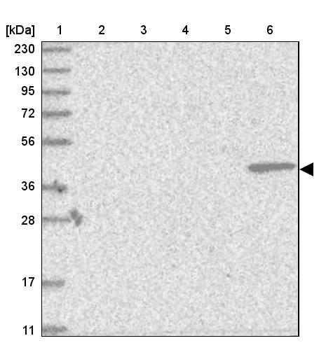 Bcl rambo Antibody - BSA Free Western Blot: Bcl rambo Antibody - BSA Free [NBP1-90002]