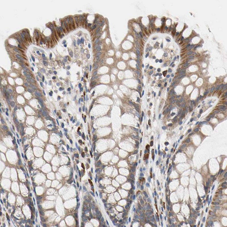 SCL/Tal1 Antibody Immunohistochemistry-Paraffin: SCL/Tal1 Antibody [NBP1-90005]