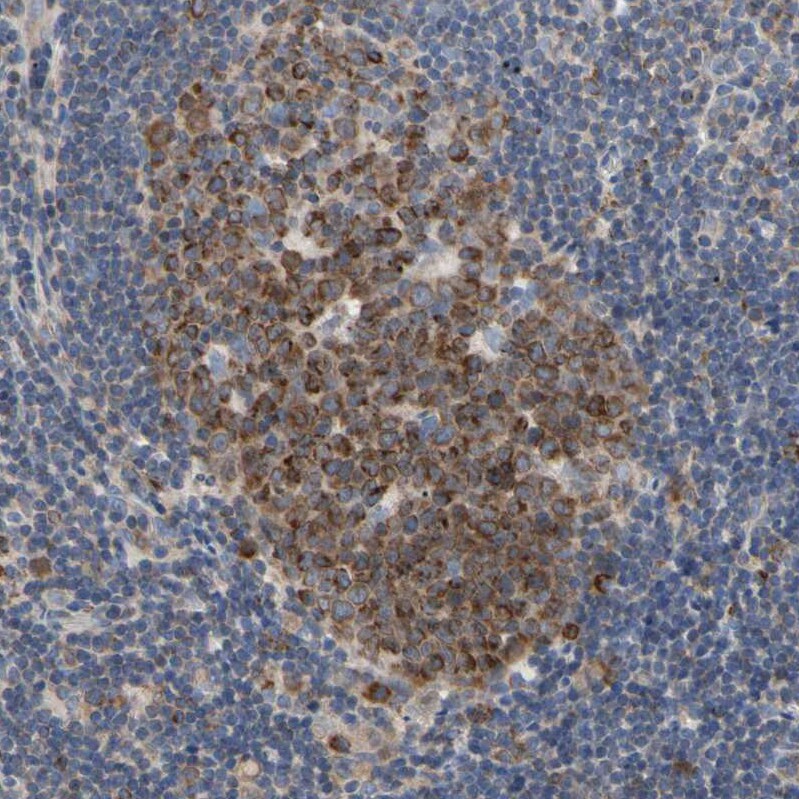 SCL/Tal1 Antibody Immunohistochemistry-Paraffin: SCL/Tal1 Antibody [NBP1-90005]