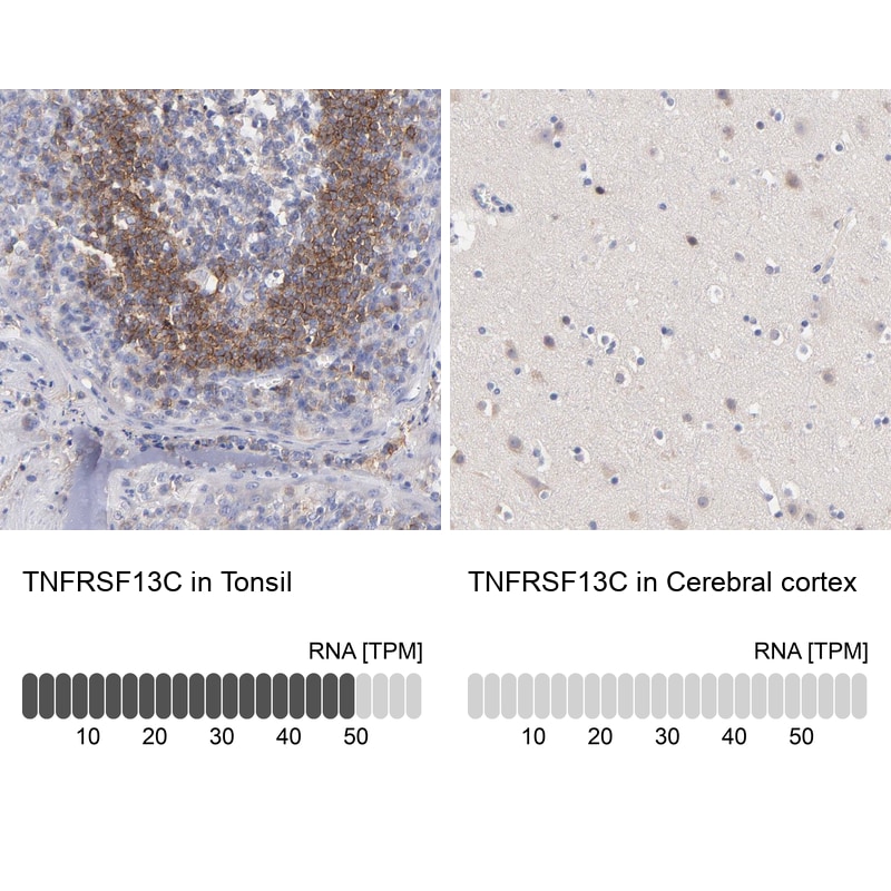 BAFFR/TNFRSF13C Antibody - BSA Free Immunohistochemistry-Paraffin: BAFFR/TNFRSF13C Antibody - BSA Free [NBP1-90011]