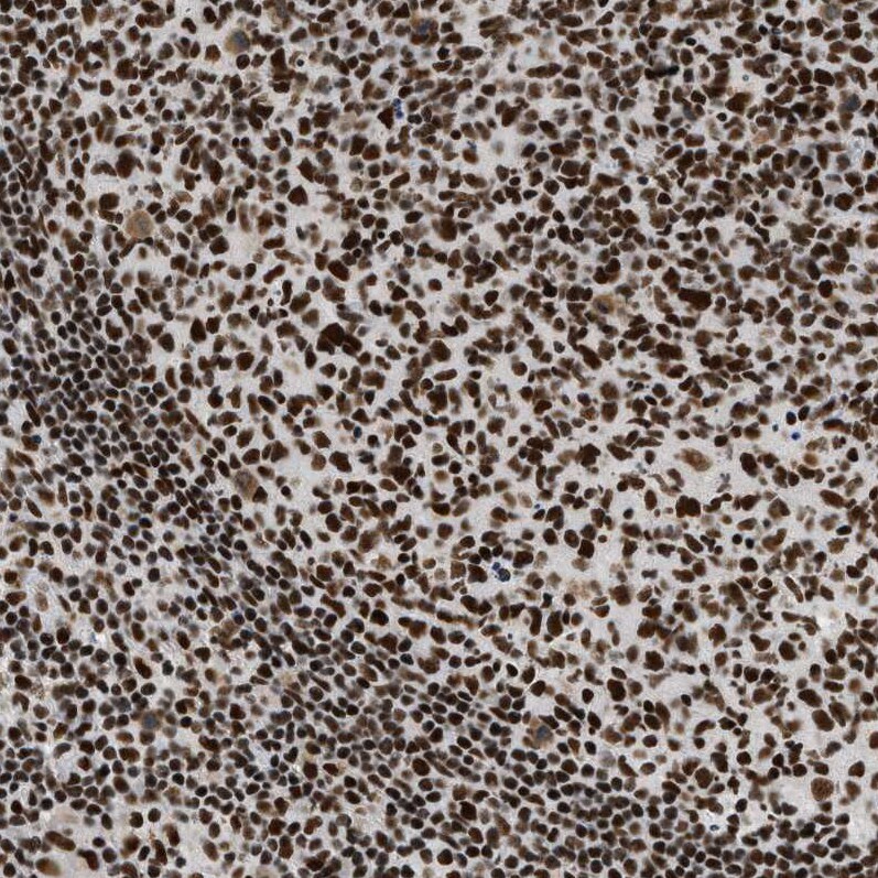 SNF5 Antibody - BSA Free Immunohistochemistry-Paraffin: SNF5 Antibody - BSA Free [NBP1-90013]