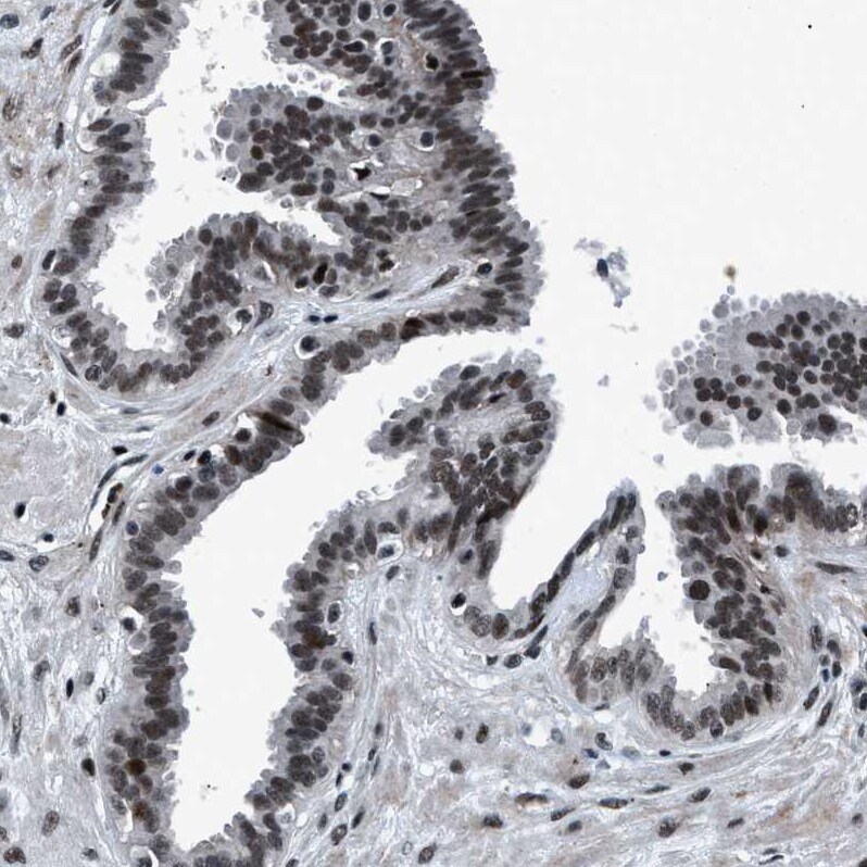 SNF5 Antibody - BSA Free Immunohistochemistry-Paraffin: SNF5 Antibody - BSA Free [NBP1-90014]
