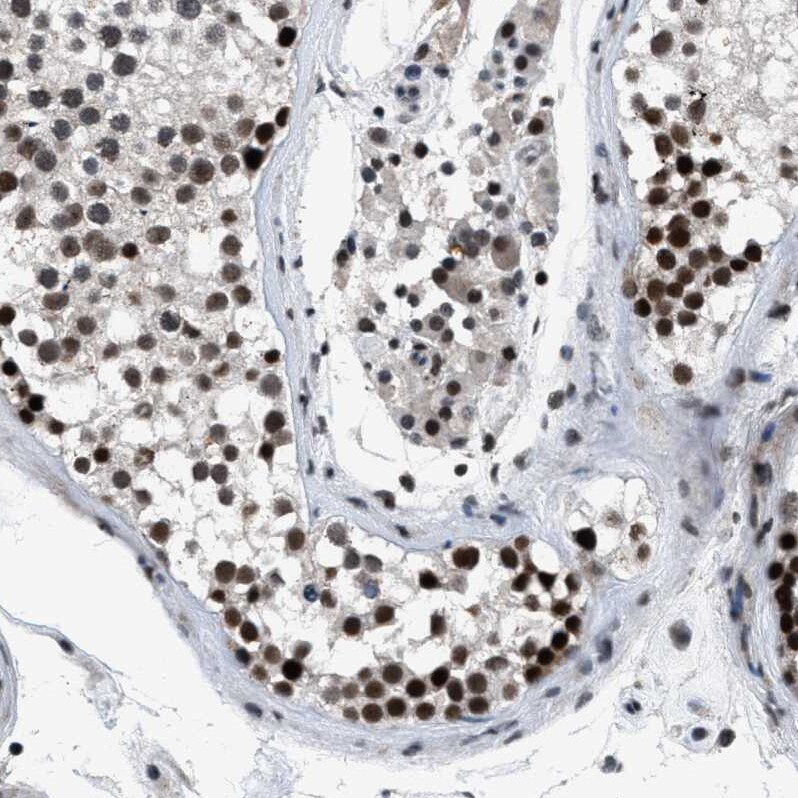 SNF5 Antibody - BSA Free Immunohistochemistry-Paraffin: SNF5 Antibody - BSA Free [NBP1-90014]