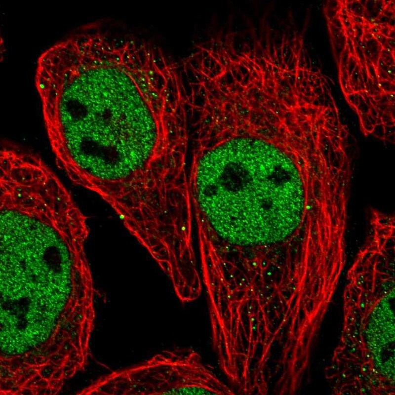 SNF5 Antibody - BSA Free Immunocytochemistry/ Immunofluorescence: SNF5 Antibody - BSA Free [NBP1-90014]