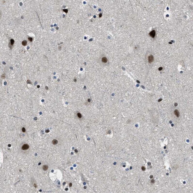 SNF5 Antibody - BSA Free Immunohistochemistry-Paraffin: SNF5 Antibody - BSA Free [NBP1-90014]